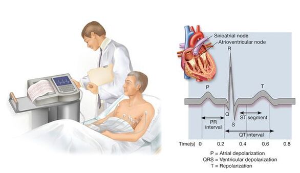 Elettrocardiografia per riconoscere le malattie cardiovascolari con la pressione alta